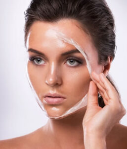 Peeling Químico em Medianeira
