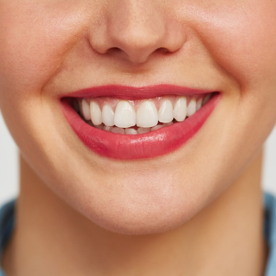 Sorriso gengival em Medianeira