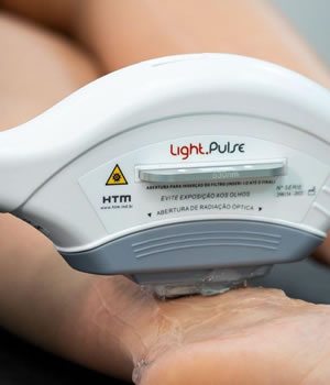 Depilação a laser em Medianeira