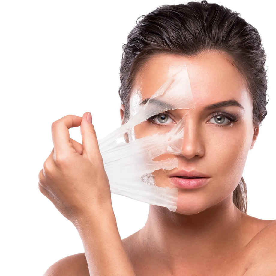 Peeling químico em Medianeira