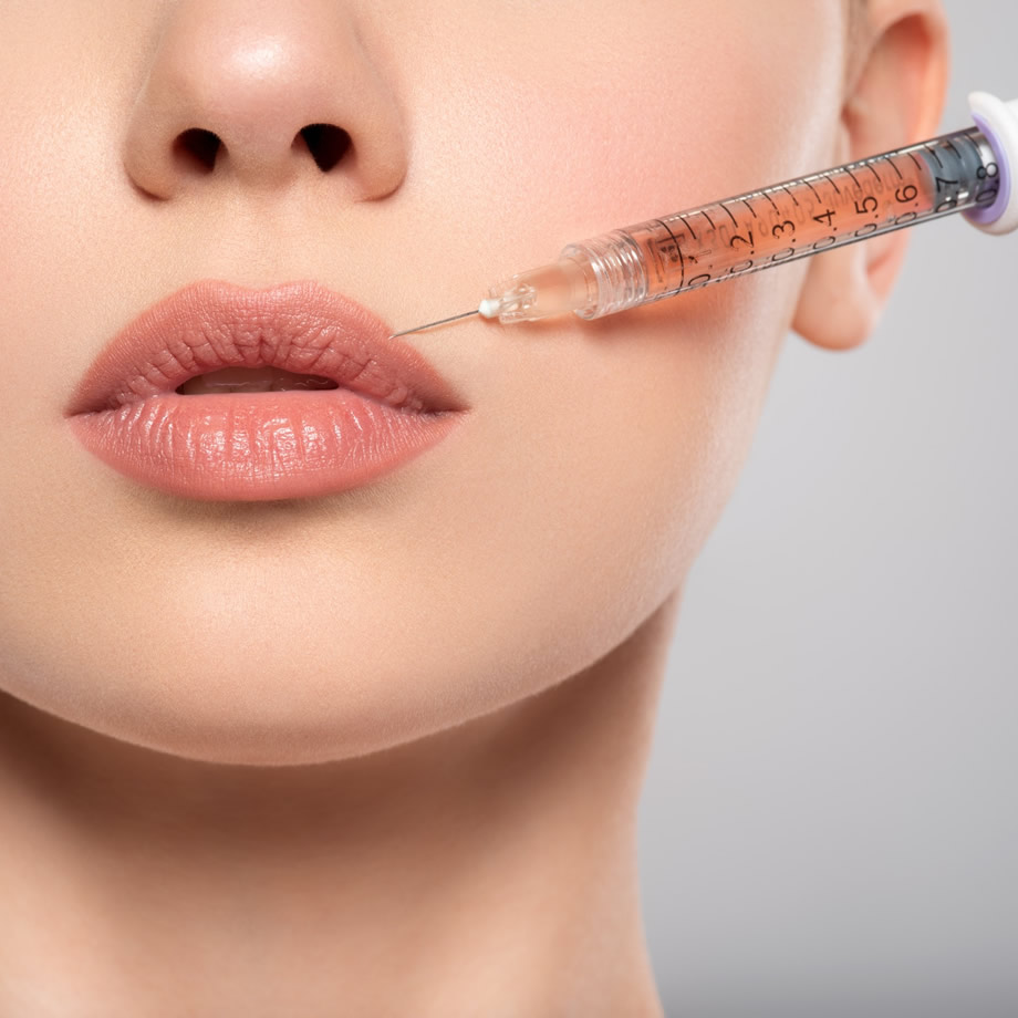 Preenchimento labial em Medianeira