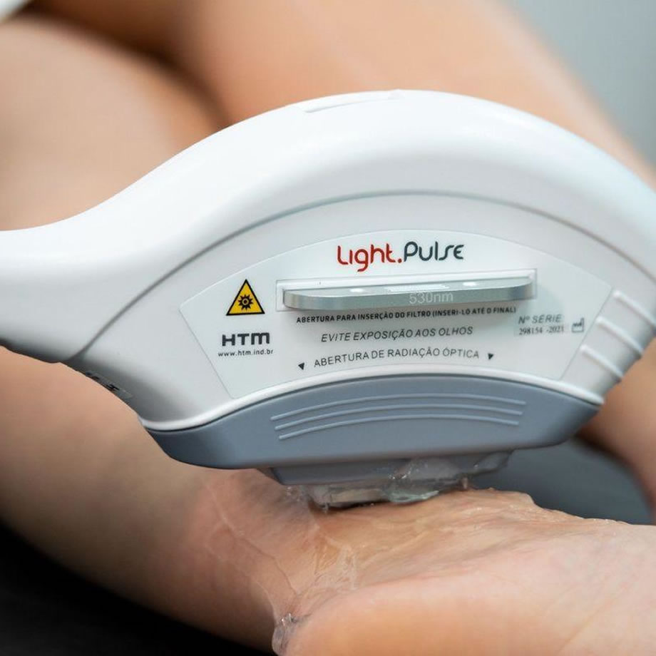 Depilação a laser em Medianeira
